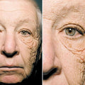 Tek Yönlü Dermatoheliyoz : Güneş ışınları sebebiyle yüzünün yarısı 20 kat daha fazla yaşlanan adam